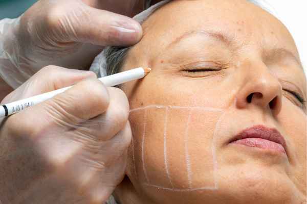 CryoPen: 5 Skin Concerns It May Be Used to Treat 4 What should you ask before having CryoPen treatment Barnet?